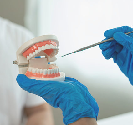 الطعوم العظمية