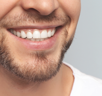 تجديد كامل الفم