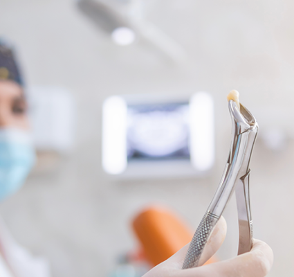 خلع اللأسنان